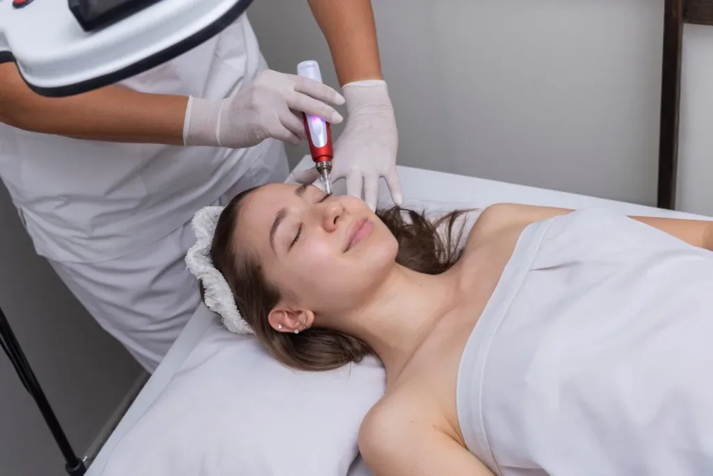 Woman receiving professional microneedling treatment at a spa, highlighting microneedling benefits for skin such as collagen production, wrinkle reduction, and improved texture.
