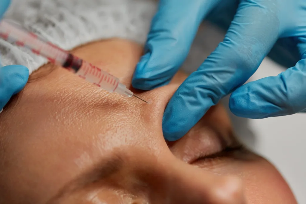 Aesthetic specialist administering Xeomin injections to a client’s forehead to smooth fine lines and reduce wrinkles in a professional spa setting.