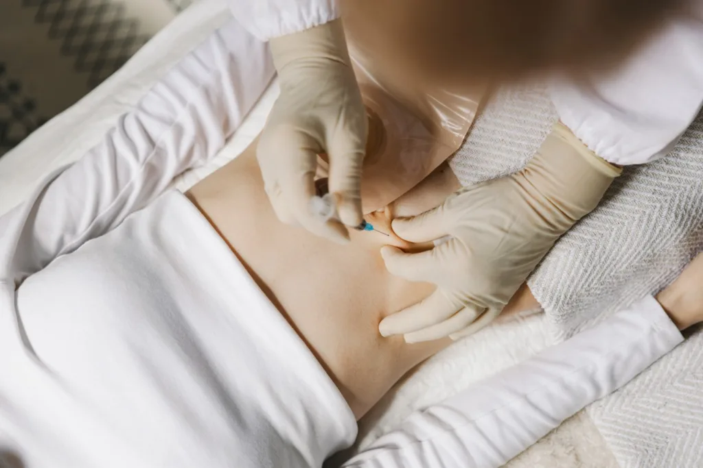 A healthcare professional administering a lipo mino injection in the abdominal area to support fat metabolism and boost energy levels.