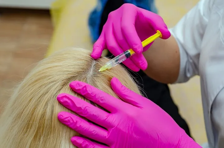 A specialist performing a prp hair restoration procedure on a patient’s scalp