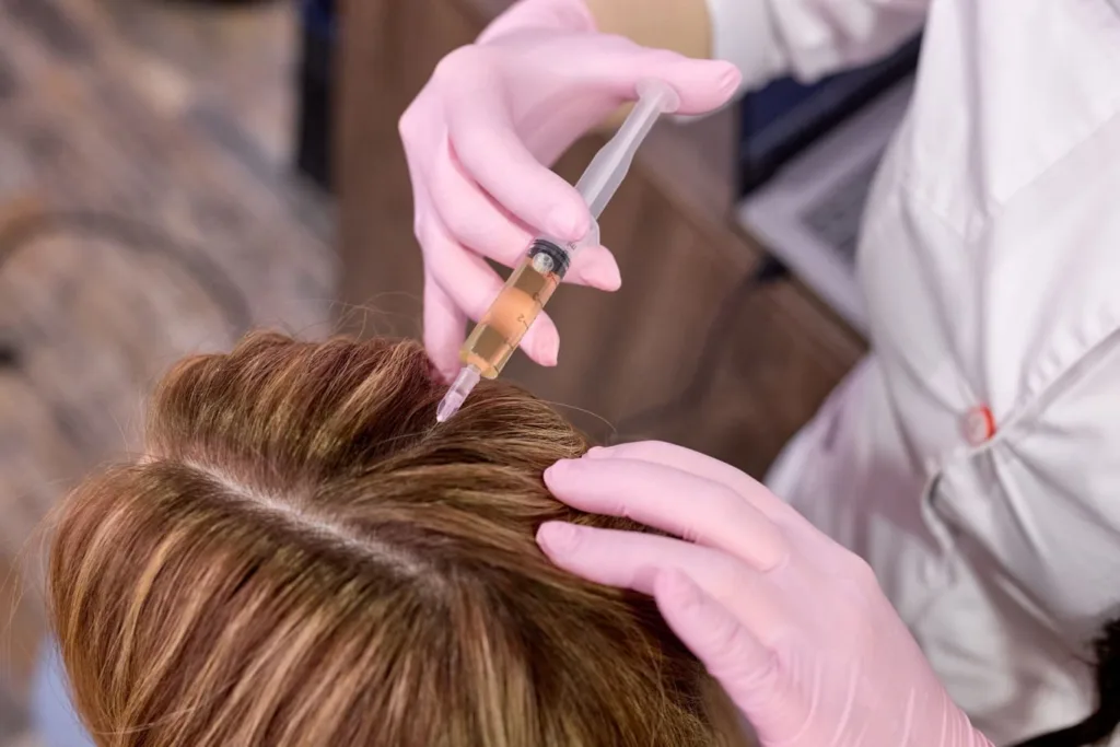 Professional hair loss treatment with scalp injection for hair regrowth