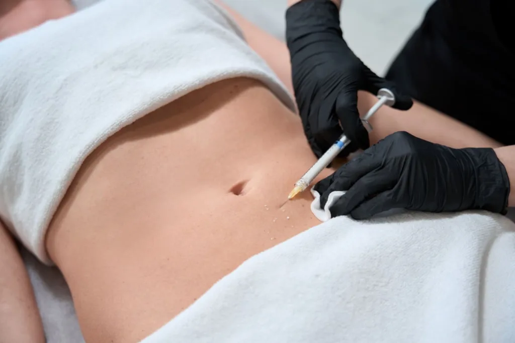 A healthcare professional administering lipo-mino injections to the abdominal area to support fat metabolism and enhance weight loss results.