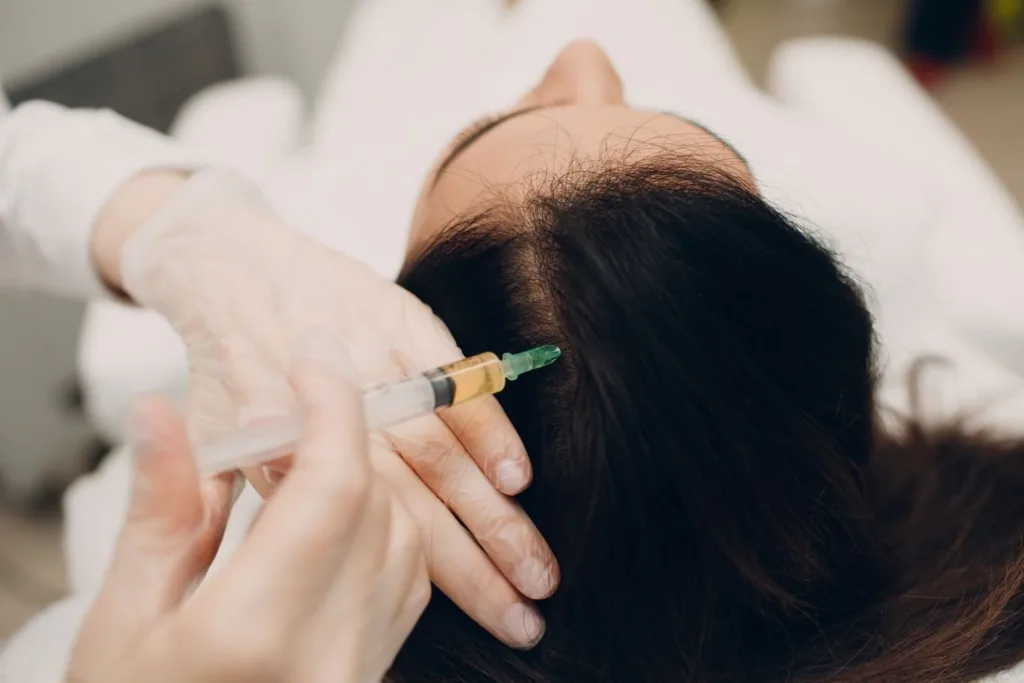 A specialist performing PRP hair treatment by injecting platelet-rich plasma into a patient’s scalp to promote natural hair growth and strengthen follicles.